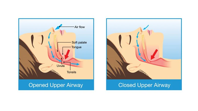 An infographic showing how do people snore