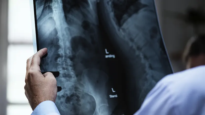 An image of a doctor examining an xray.